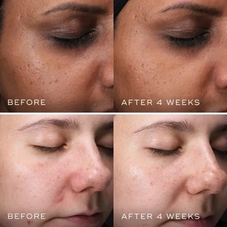 Пептидна сироватка з 10% ніацинаміду Medik8 - CLARITY PEPTIDES&trade; 30 мл